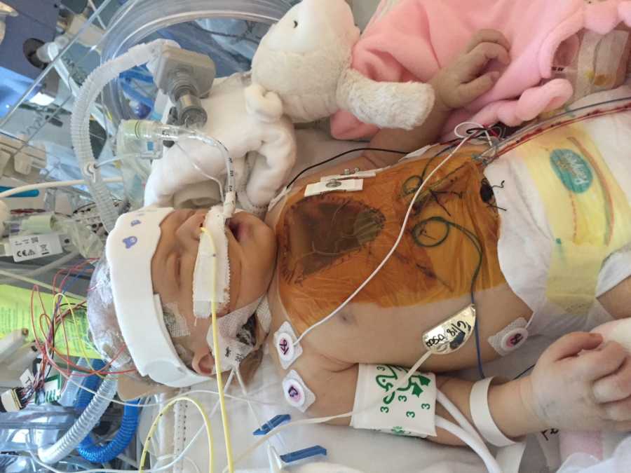 Newborn lying in NICU after open heart surgery