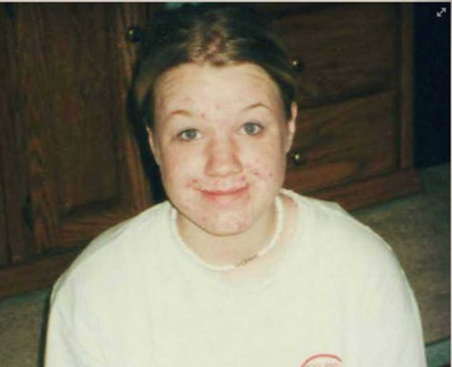 Teen girl with acne smilies while sitting on ground of home smiling