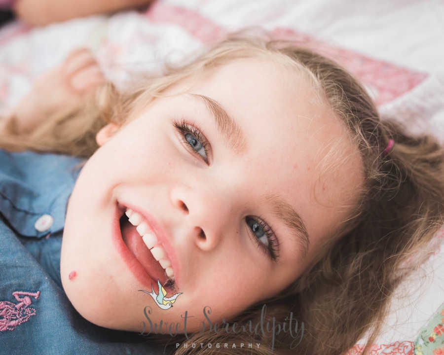 Close up of smiling little girl's face who has shaken child syndrome