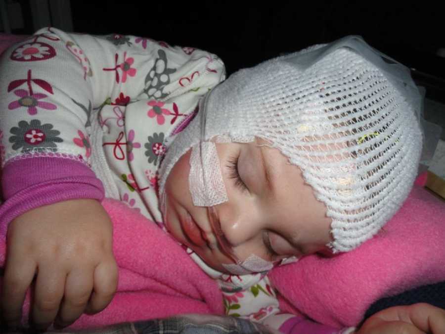 Baby girl lays asleep on oxygen with white gauze cap over her head