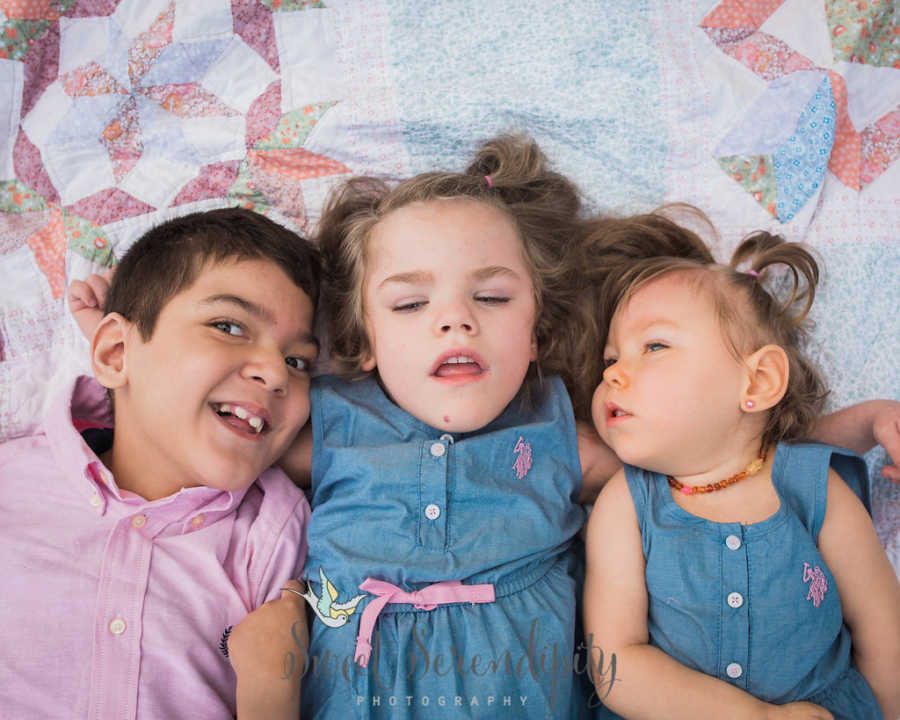 Two foster kids with shaken child syndrome lay on blanket with third who has bilateral open lip schizencephaly