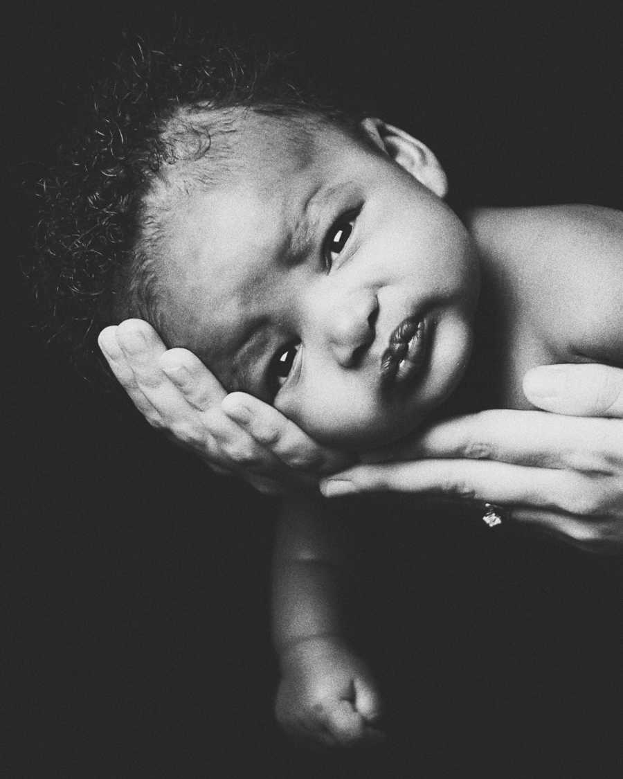 Close up of adopted child's head resting on parent's hand for photoshoot