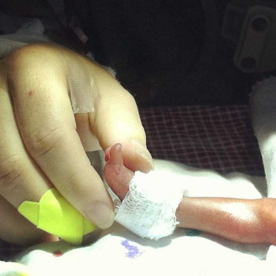 Hand holding preemie baby's foot who will die