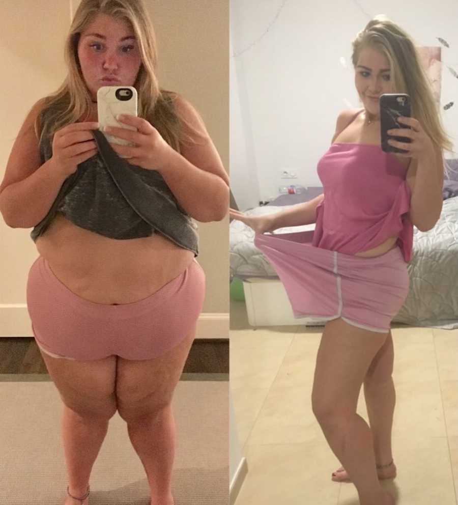Woman wearing pink shorts in mirror selfie before and after gastric bypass surgery