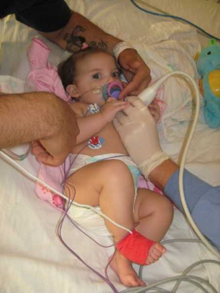 Baby with sleep apnea lays in hospital while nurse tends to her and father is beside her
