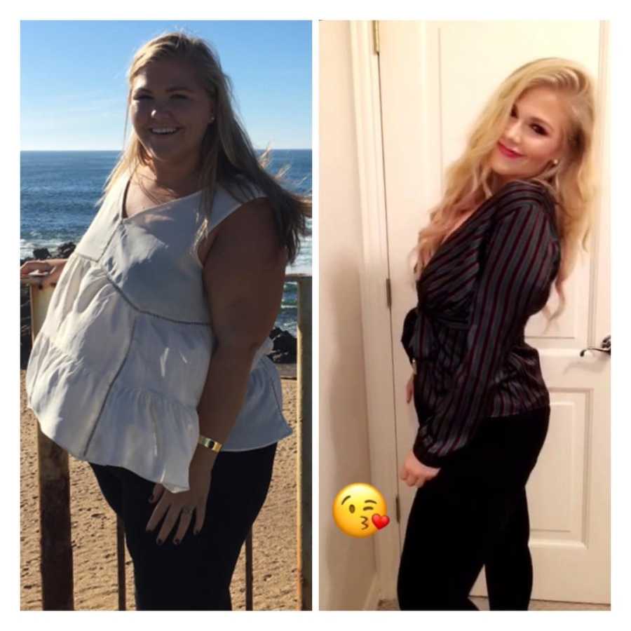 Woman standing in front of ocean beside her in home after gastric bypass surgery