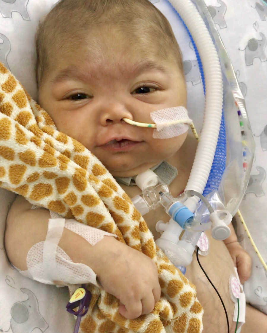 Baby with HLH lies in hospital with tube up his nose holding onto giraffe stuffed animal