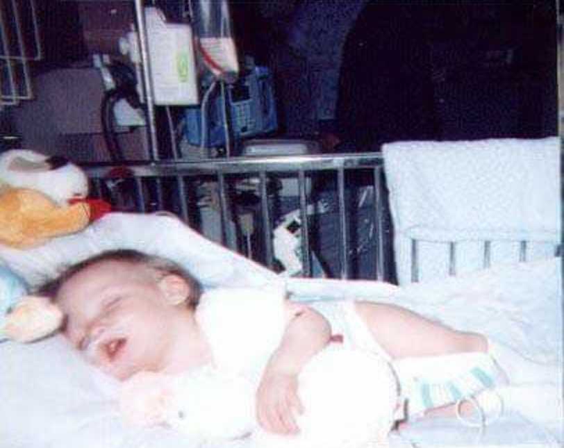 Baby with shaken baby syndrome lays in PICU asleep