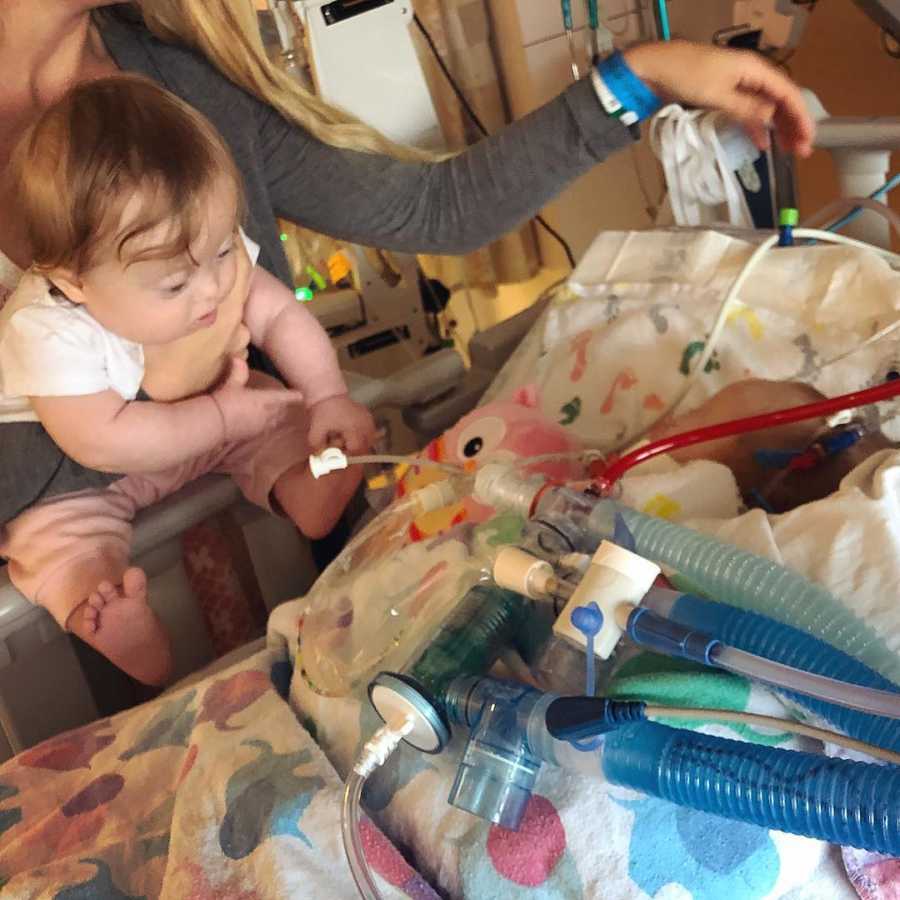 Mother holds twin who looks at other twin that is in PICU after open heart surgery