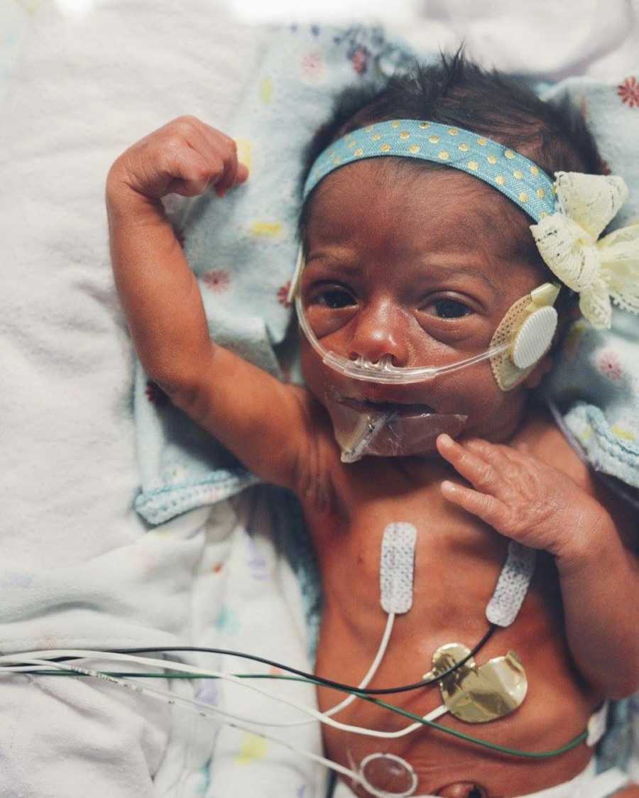 Preemie adopted baby in NICU on oxygen