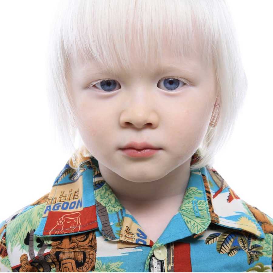 Close up of albino little boy with bright white hair wearing Hawaiian shirt