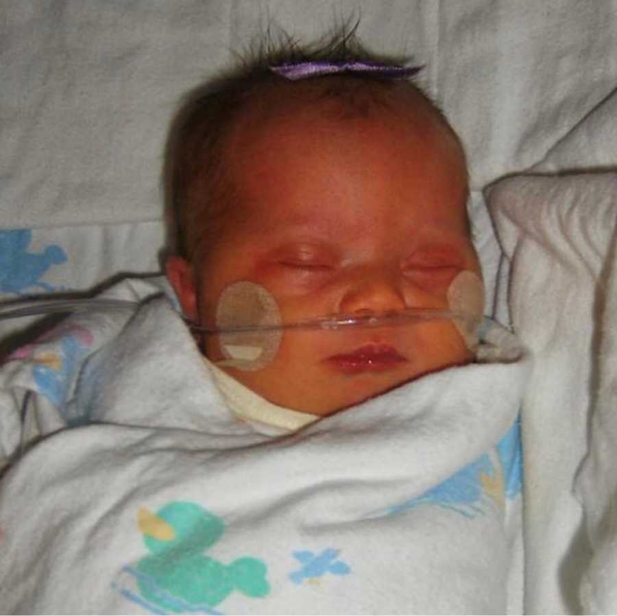 Newborn with down syndrome lays asleep in NICU