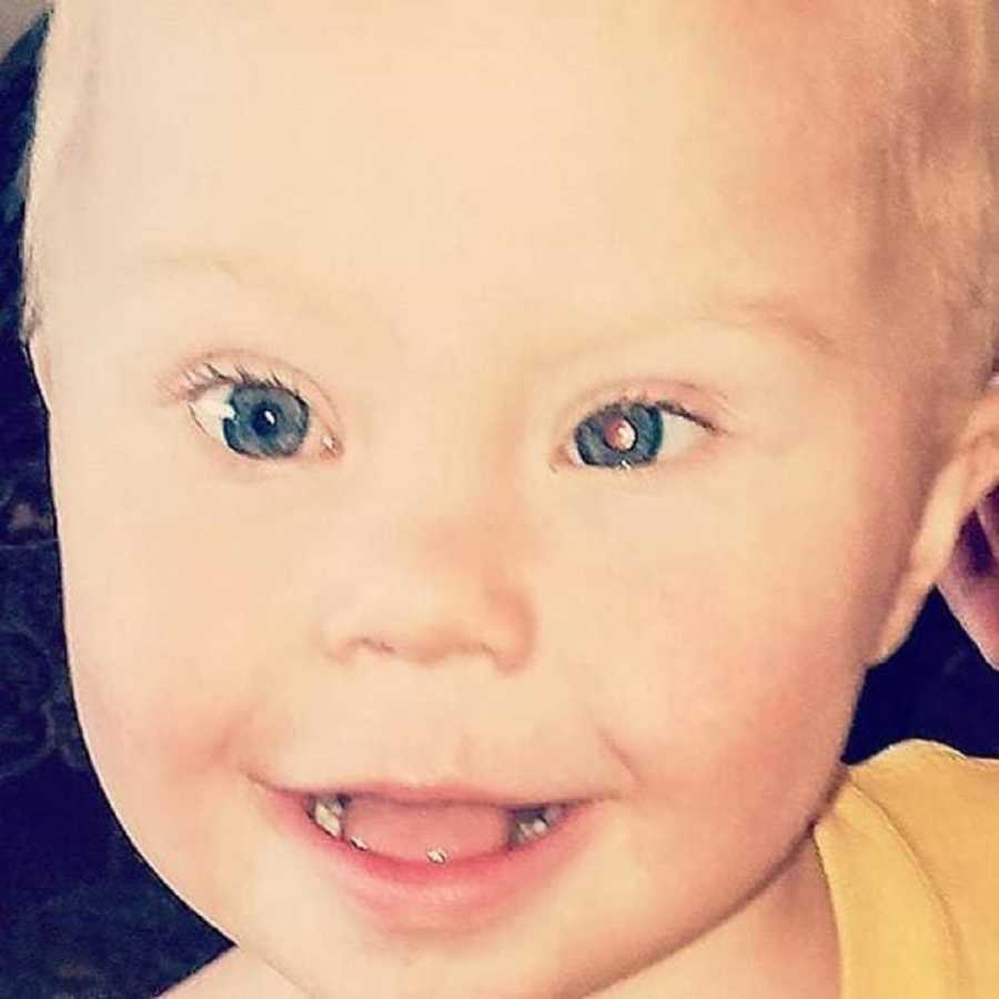 Close up of smiling baby with down syndrome's face