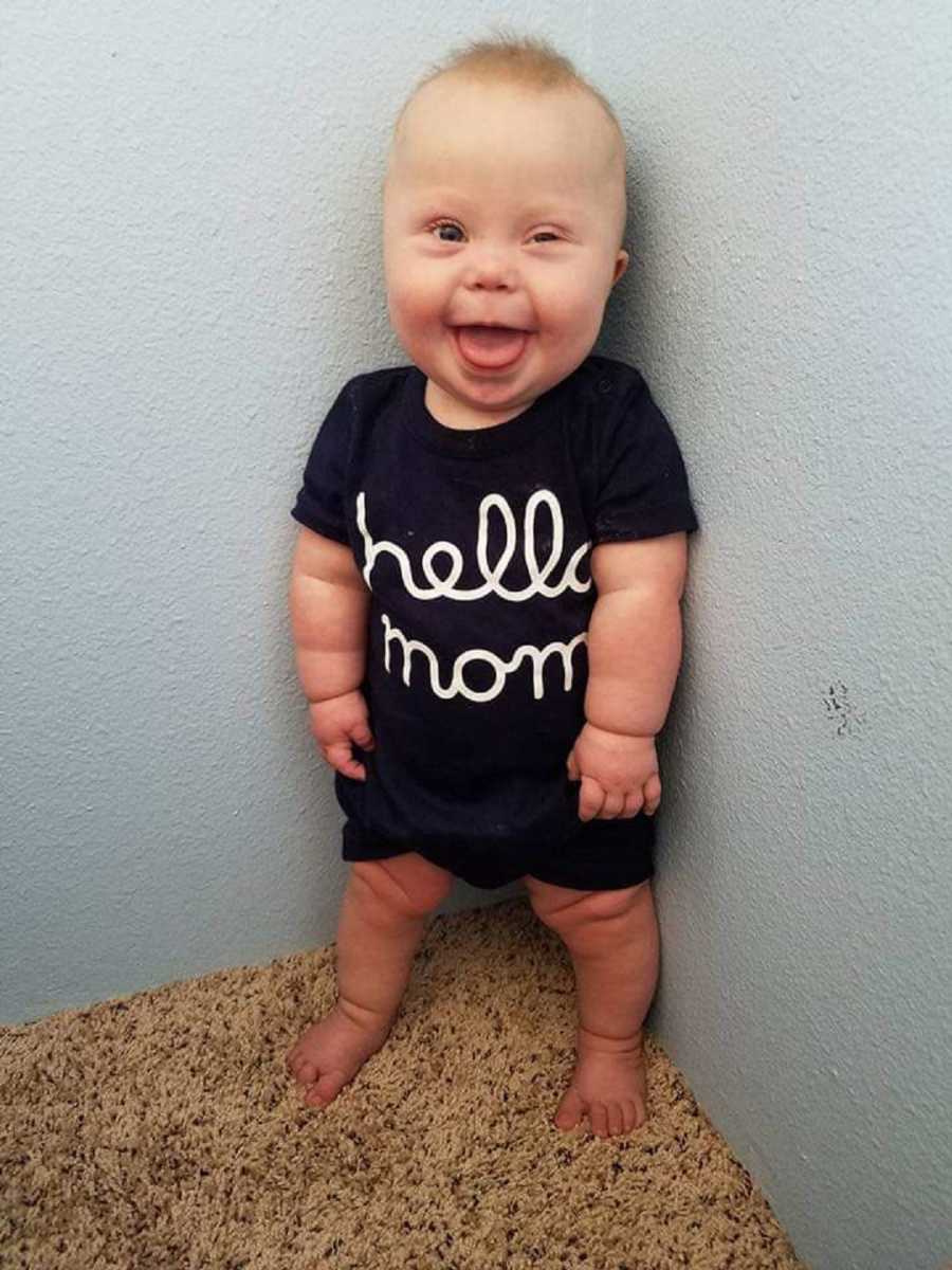 Baby with cancer and down syndrome standing in corner of room smiling