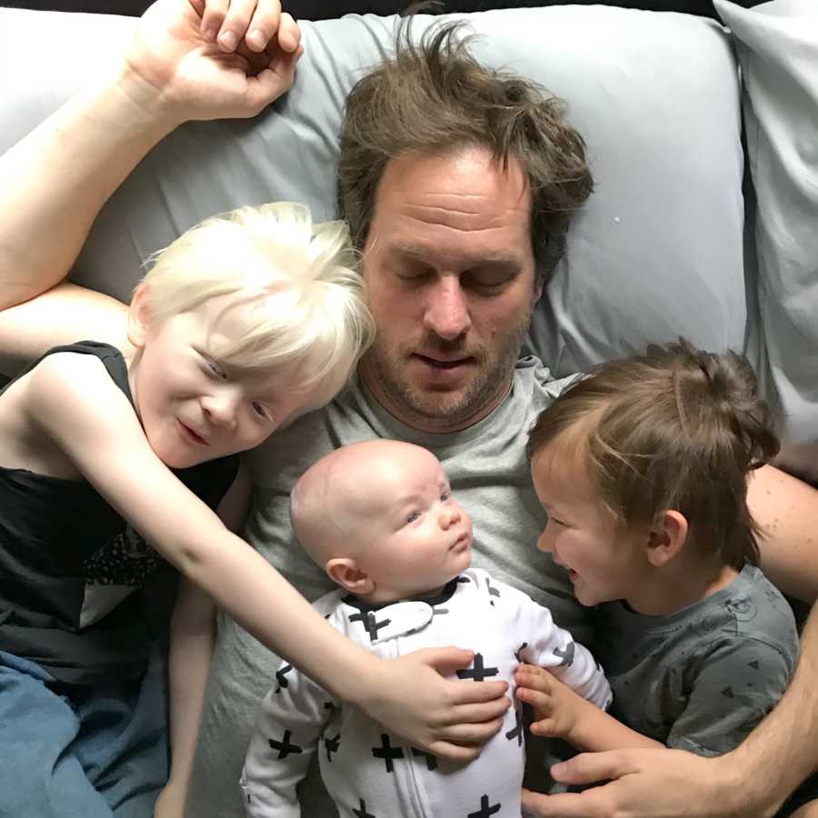 Father lays on his back in bed with albino baby laying on his chest with other albino son and third son beside him