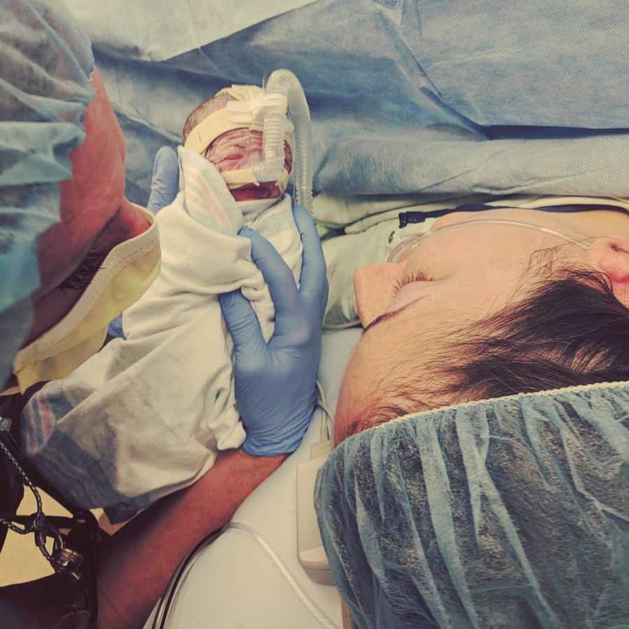 Mother looking at newborn nurse holds that has to be ruched to NICU and attached to CPAP machine