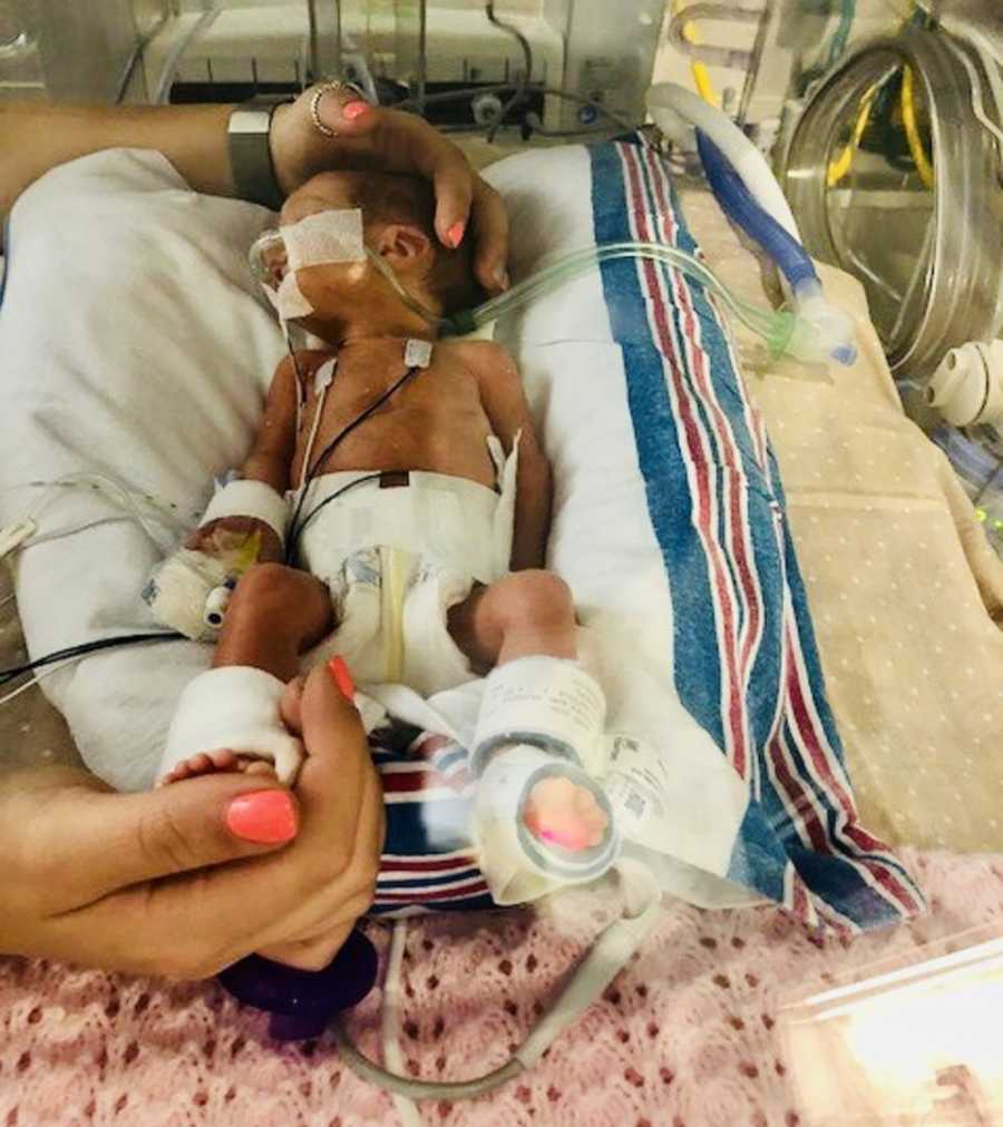 Preemie lays in NICU connected to monitors while woman's hands hold head and foot