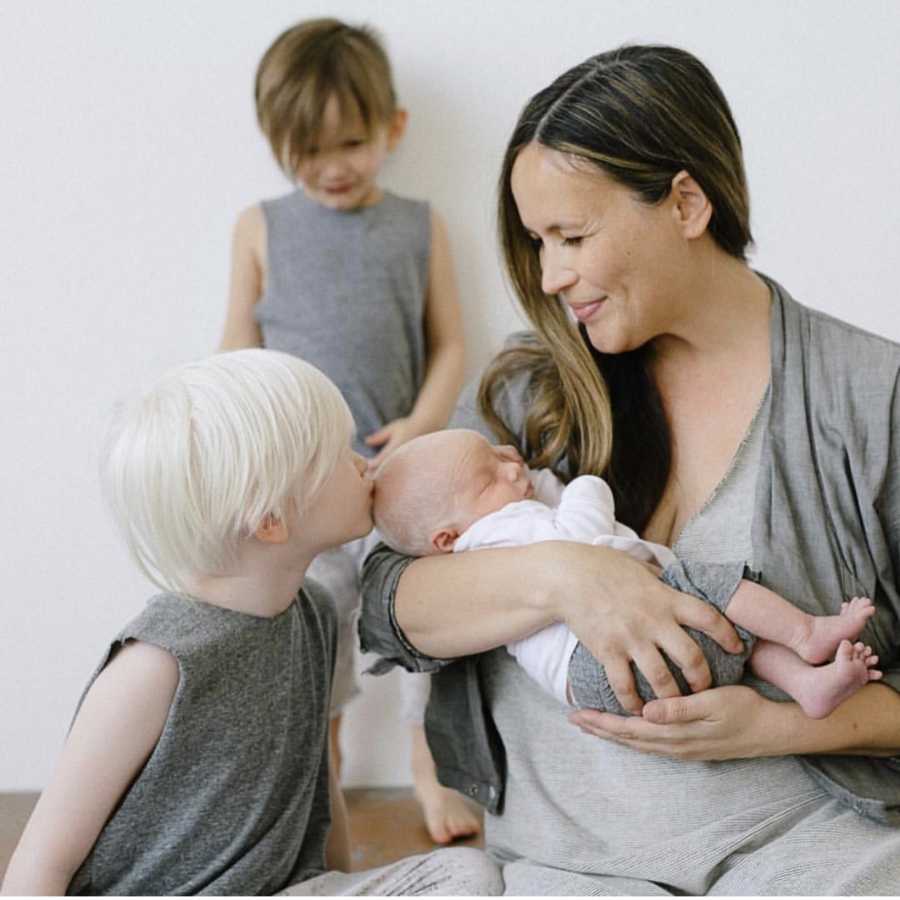 Mother holds albino baby while other albino son kisses him with third son in background