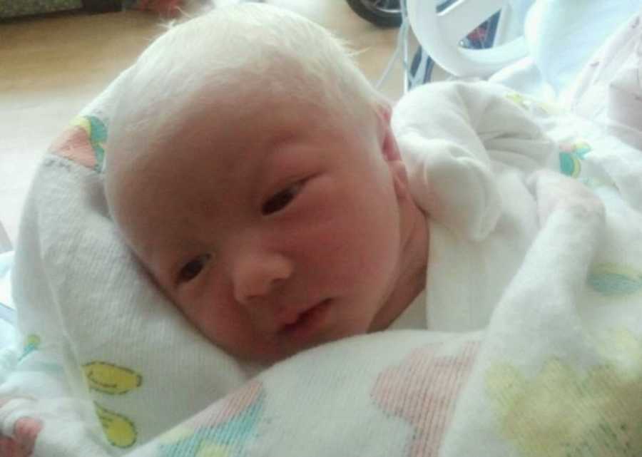 Newborn albino swaddled in blanket in hospital room