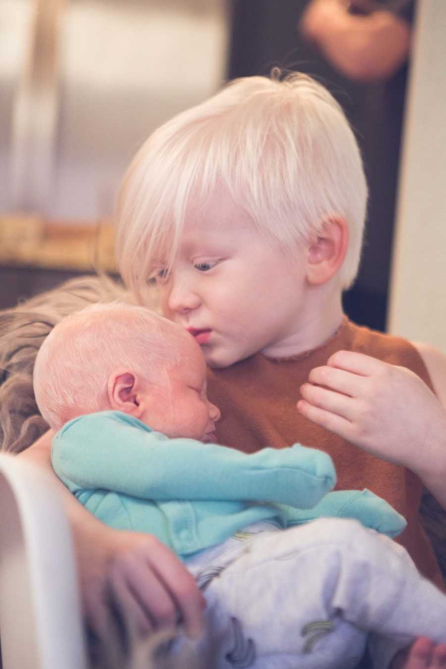 Albino toddler boy sits holding albino baby brother in his arms