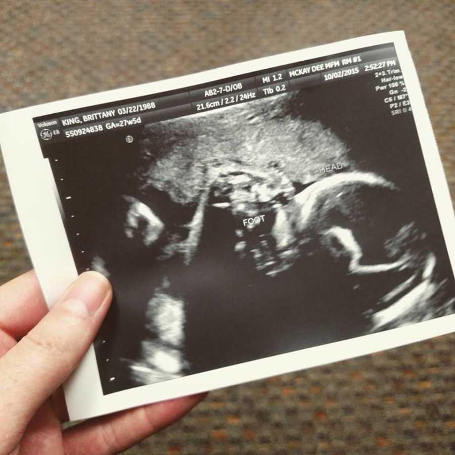 Hand holding ultrasound picture 