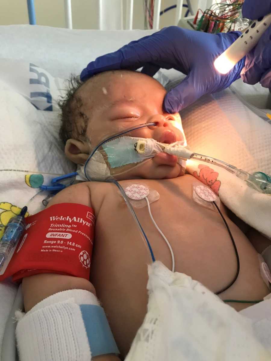 Baby with shaken baby syndrome lays in hospital bed while doctor looks into his eyes with flashlight