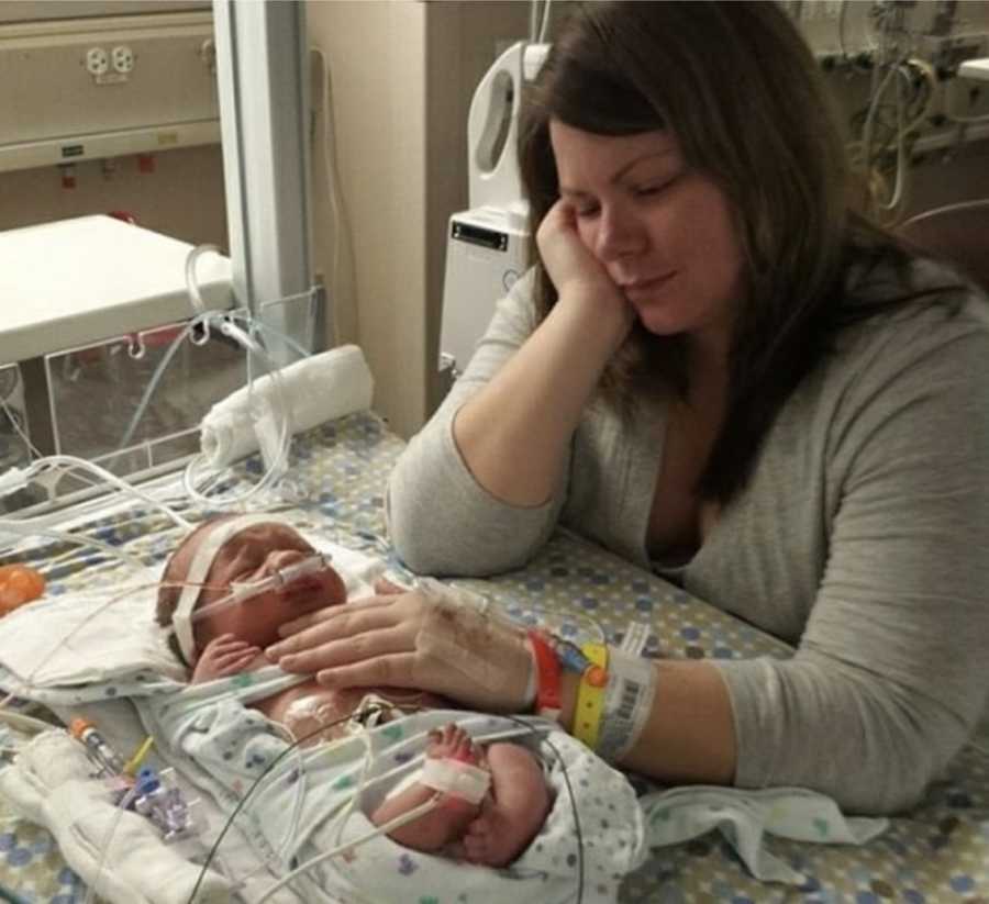 Mother sits beside newborn in NICU with dwarfism resting hand on his chest