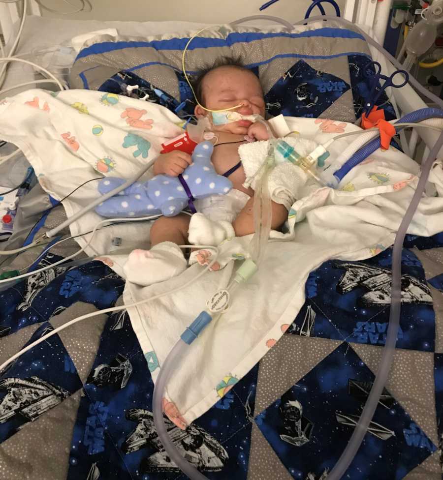 Baby with shaken baby syndrome lays in hospital bed connected to monitors