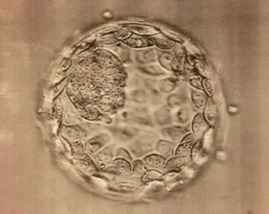 Close up of cell in blastocyst stage