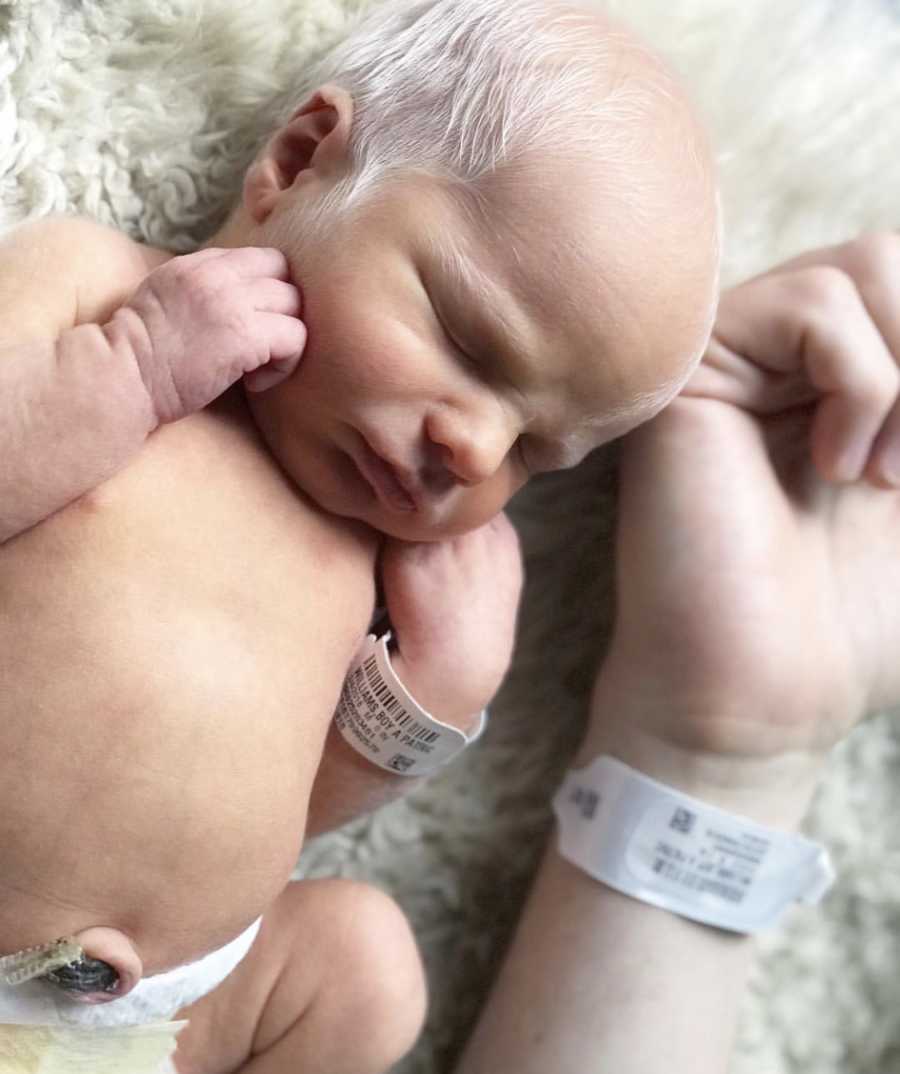 Newborn albino baby lays on back beside mother's arm