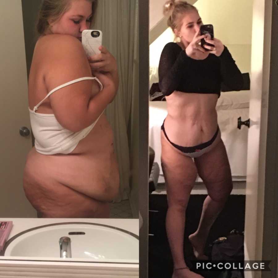 Mirror selfie of woman before and after gastric bypass surgery