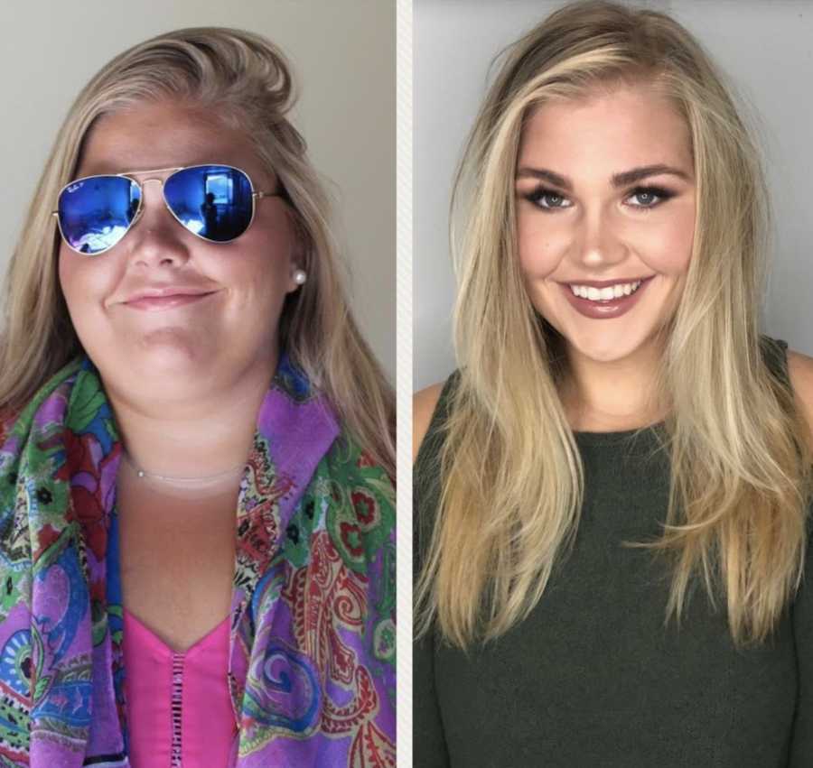 Woman smiling in images before and after gastric bypass surgery