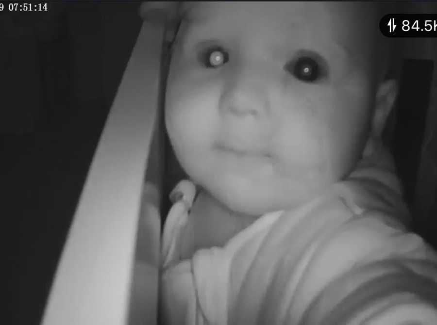 Screenshot of baby cam footage of baby with pupils that are two very different sizes