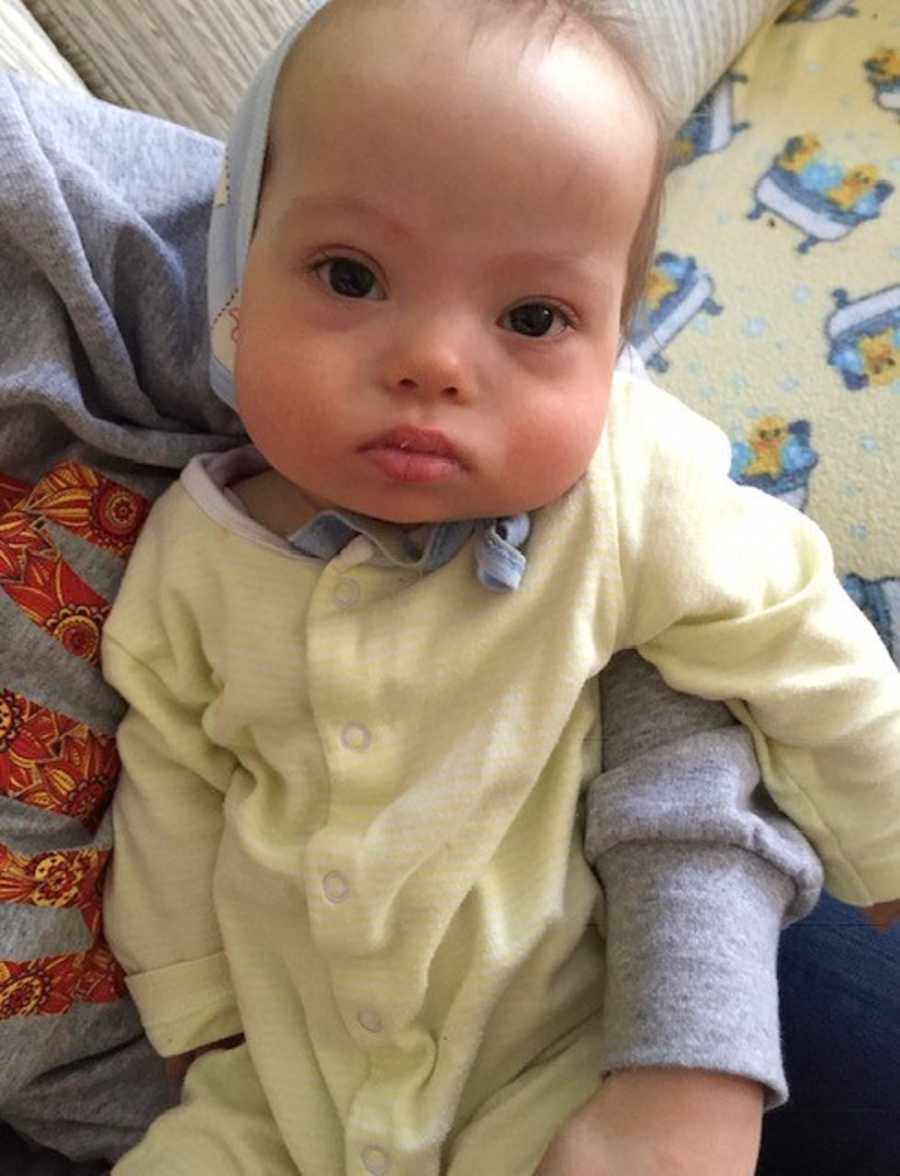 Adopted baby boy from Ukraine with down syndrome lying in parents arm in yellow onesie