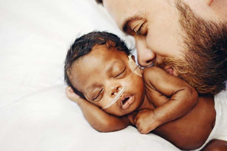 Preemie baby on oxygen lays asleep while adopted father kisses her arm