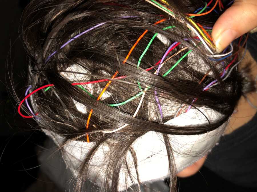 Top of little boys head who had a seizure that is covered in colored wires