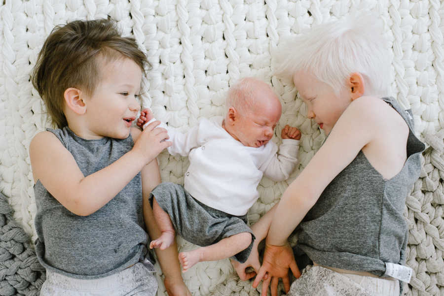 Two older brothers, one of which is albino lay on ground with albino baby brother between them