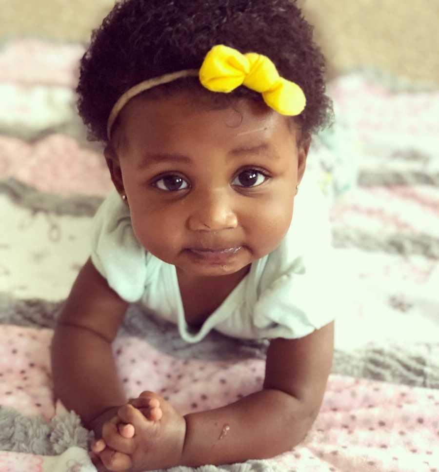 Adopted baby girl lays on stomach with yellow bow in her hair