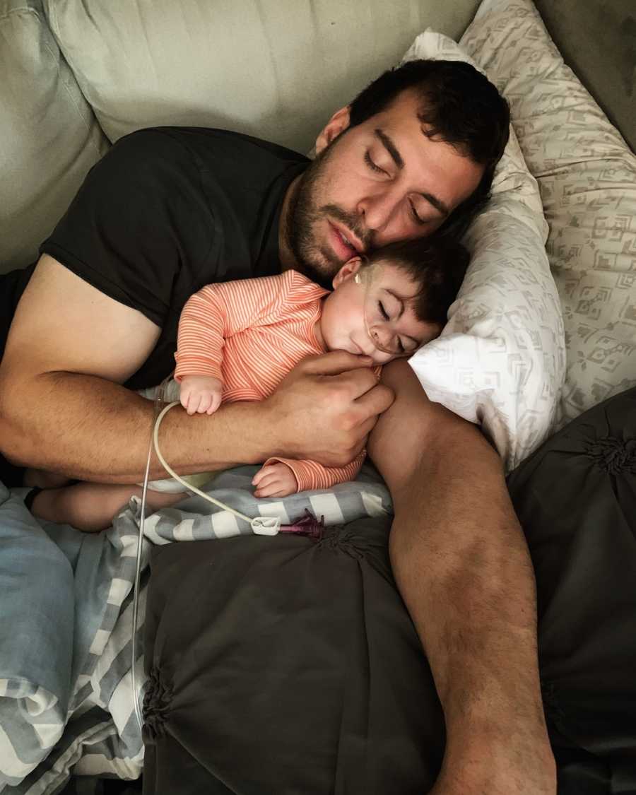 Father lays asleep with baby who has Cornelia de Lange syndrome in his arms
