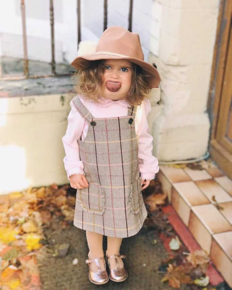 Little girl with cystic hygroma stands on door mat with tongue out