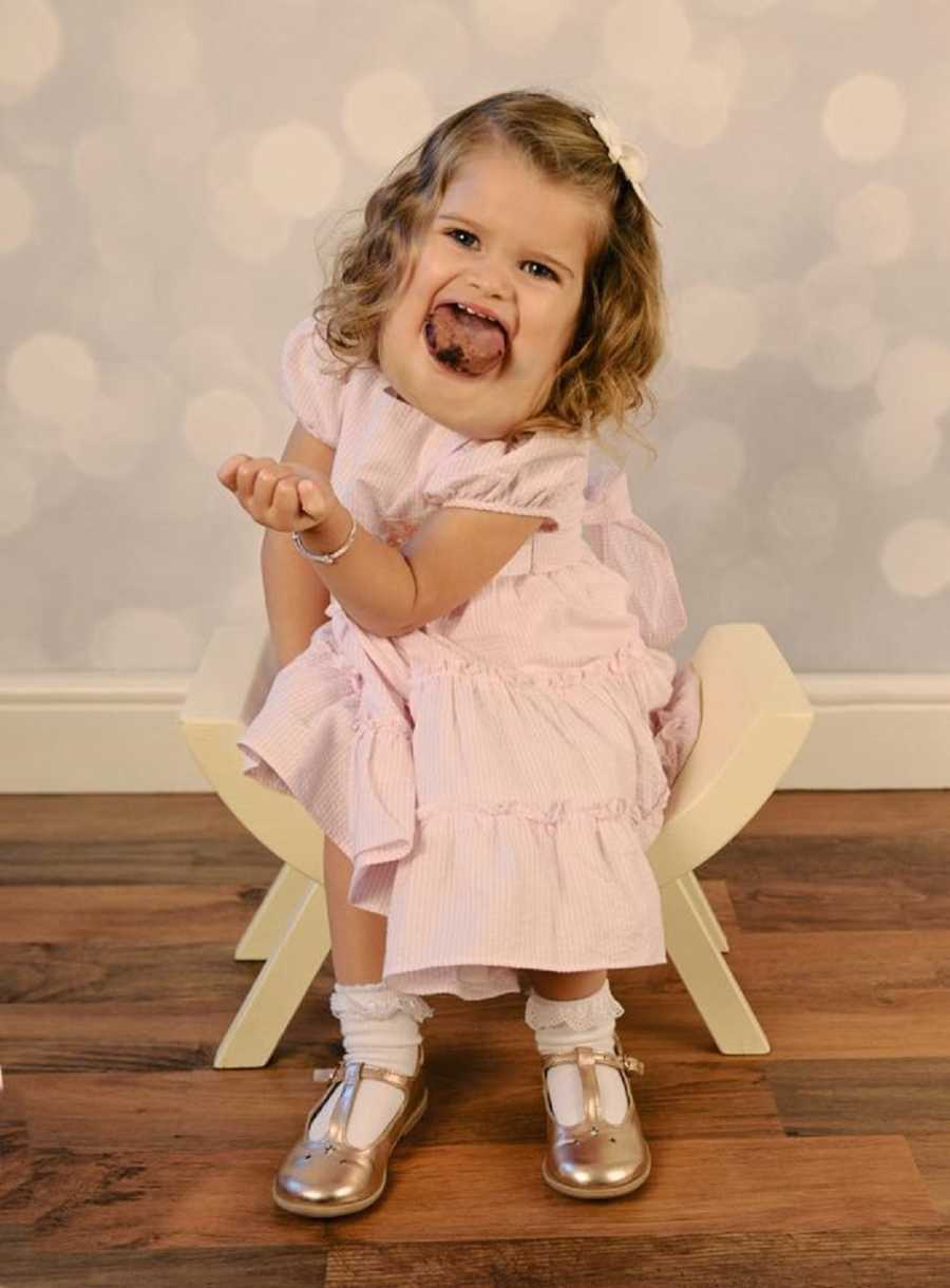 Little girl with cystic hygroma smiles in chair in home wearing light pink dress