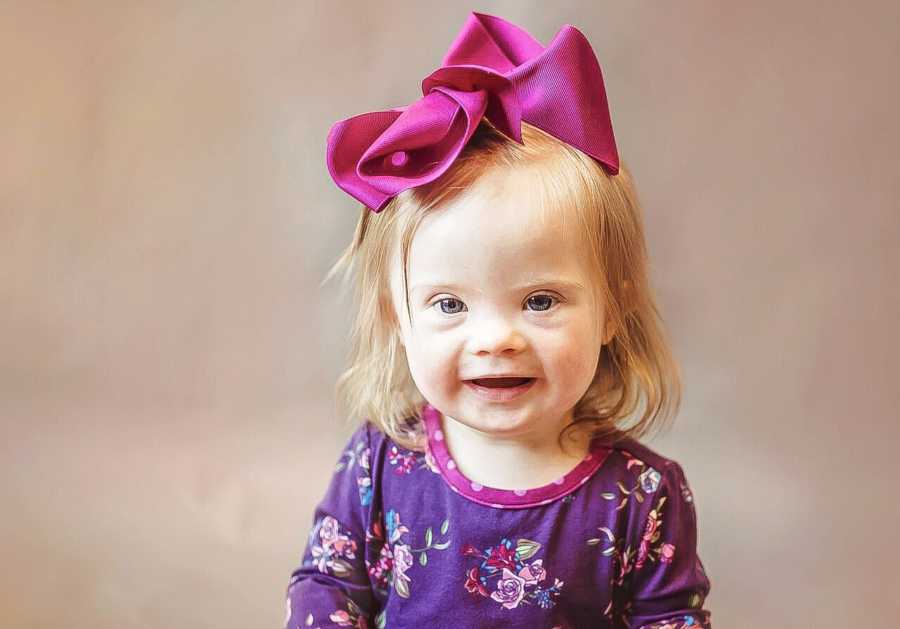 Little girl with down syndrome smiles wearing purple dress and pink bow on her head