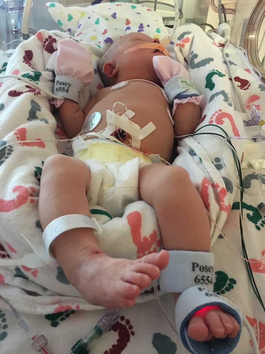 Baby with down syndrome lays on her back in NICU with pink mittens on 