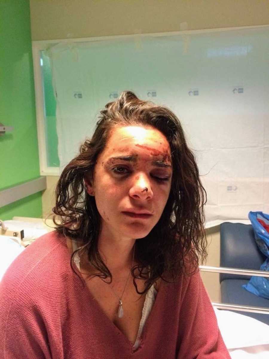 Woman sits up in international hospital with beaten face after being attacked