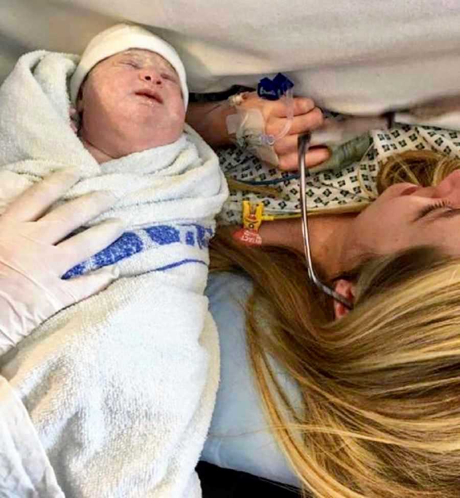 Hands hold newborn with lymphatic malformation beside head of mother who had c-section
