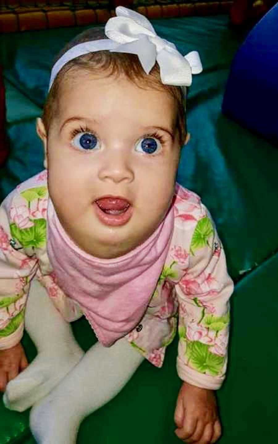 Baby with cystic hygroma sits on floor of home looking up with white bow on her head