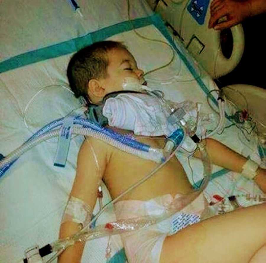 Little boy lays in hospital connected to monitors after tv tipped over on him