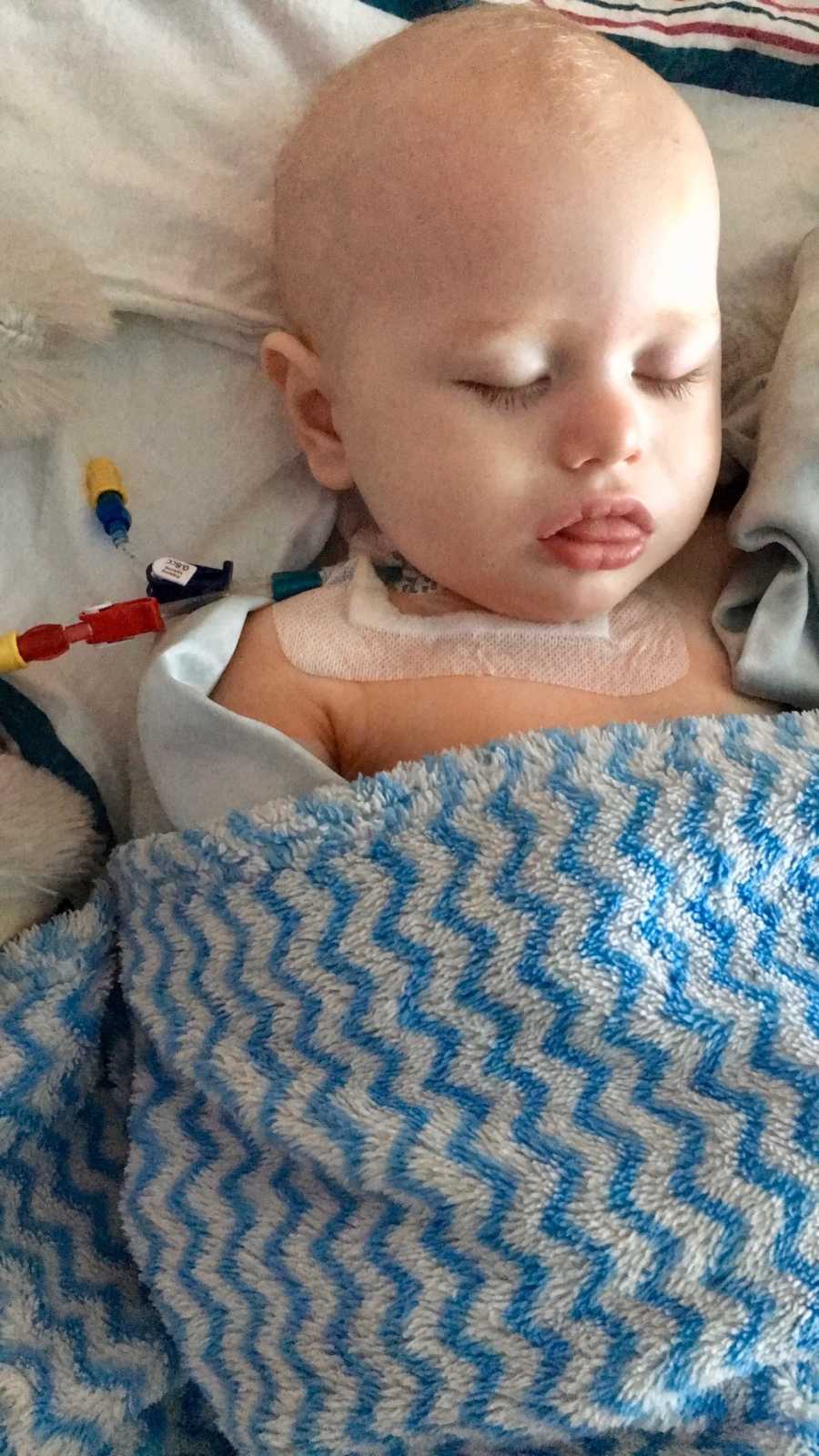 Baby with Transverse Myelitis lays asleep in hospital bed wrapped in blue and white chevron blanket