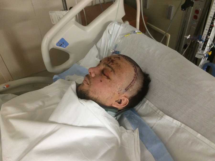 Man lays asleep in ICU after car crash