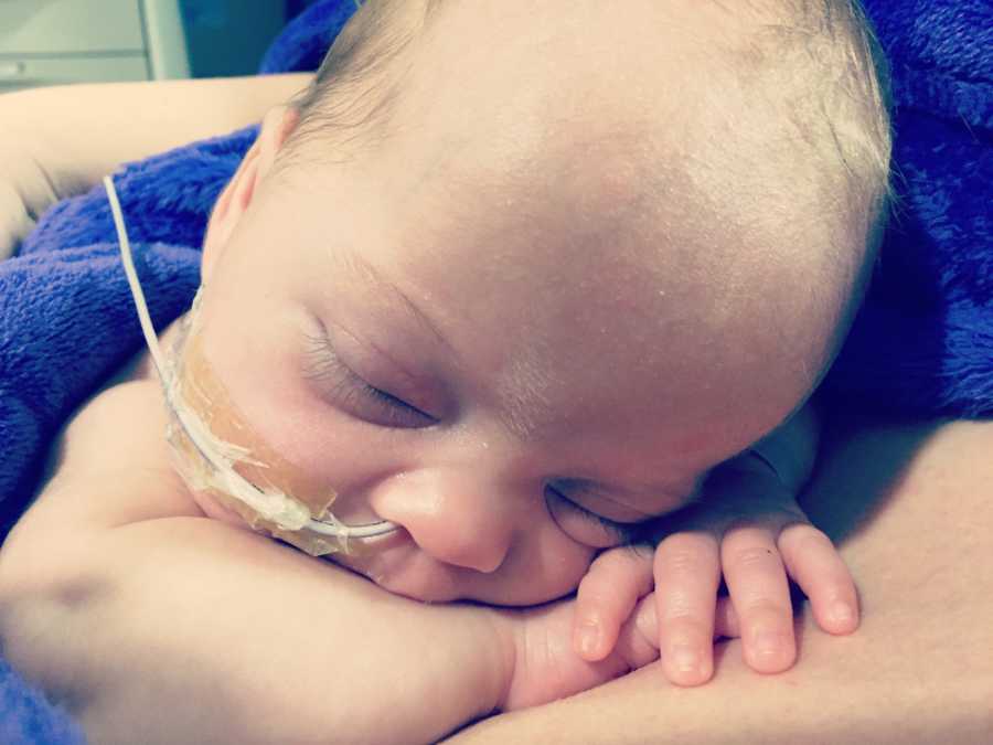 Little baby lays asleep with head rested on her hands and tube up her nose